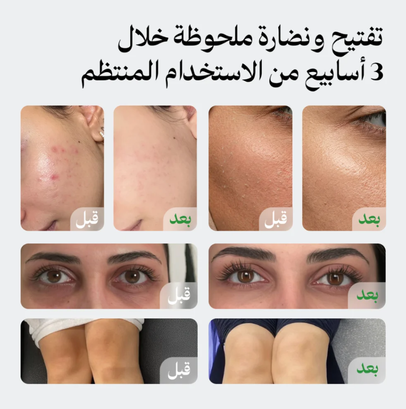 مجموعة لونيل المتكاملة